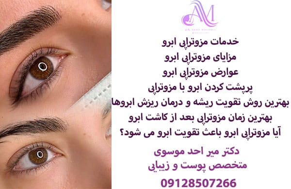 خدمات مزوتراپی ابرو