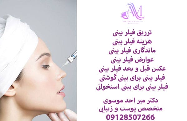 تزریق فیلر بینی