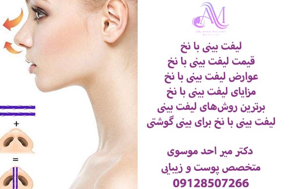 لیفت بینی با نخ