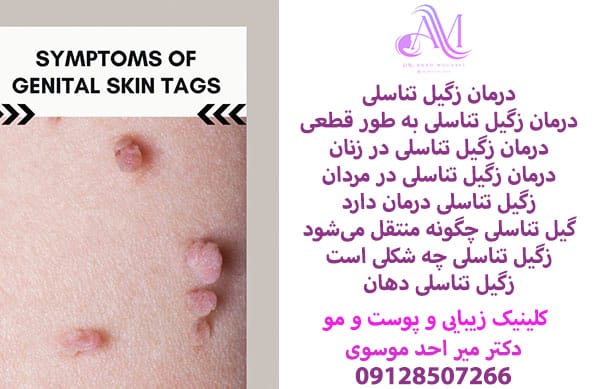 درمان رگیل تناسلی