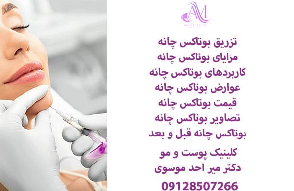 تزریق بوتاکس چانه