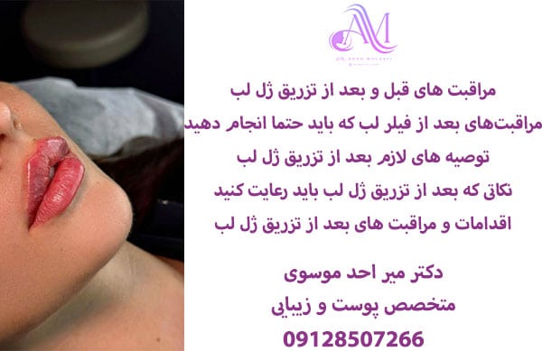 مراقبت های قبل و بعد از تزریق ژل لب