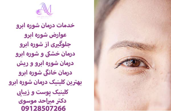 عوارض شوره ابرو