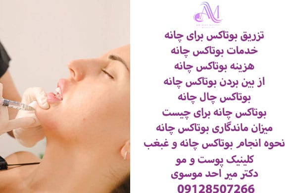 هزینه بوتاکس چانه