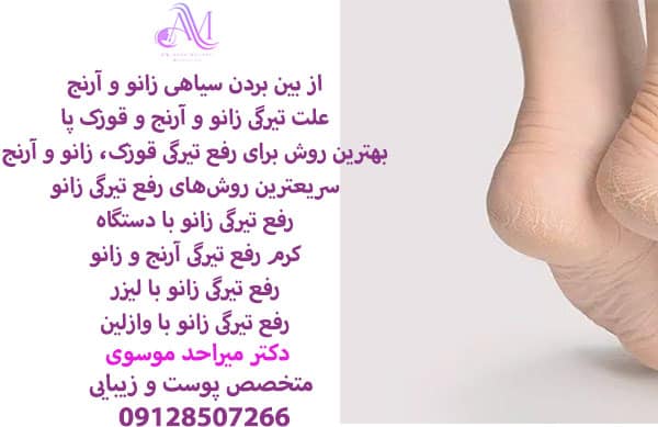 رفع سیاهی قوزک پا