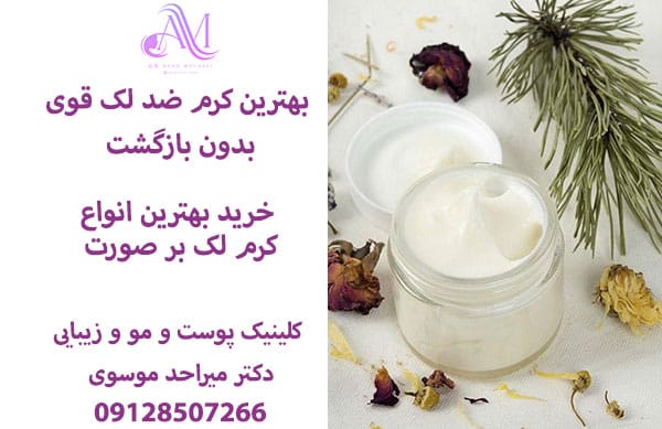 بهترین کرم ضد لک قوی بدون بازگشت