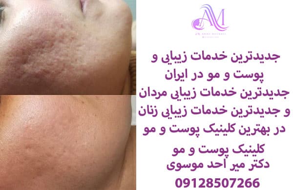 جدیدترین خدمات زیبایی