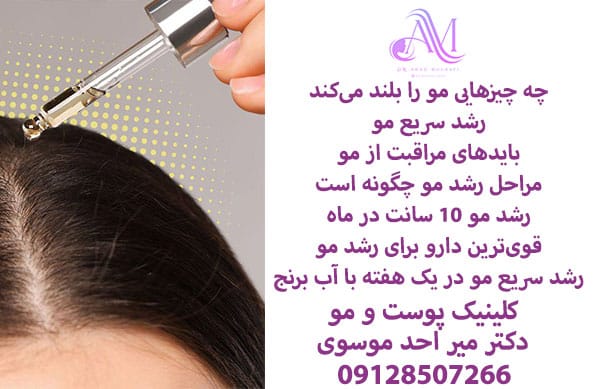 چه چیزهایی مو را بلند میکند