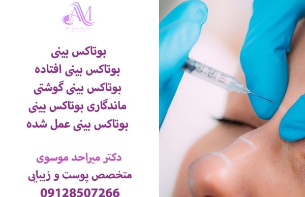 بوتاکس بینی گوشتی