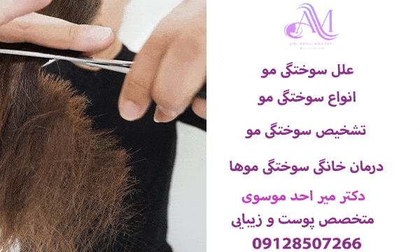 دلایل سوختگی و آسیب دیدگی موها