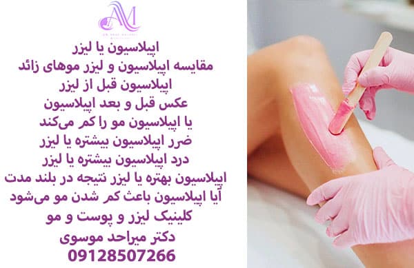 مقایسه اپیلاسیون و لیزر موهای زائد