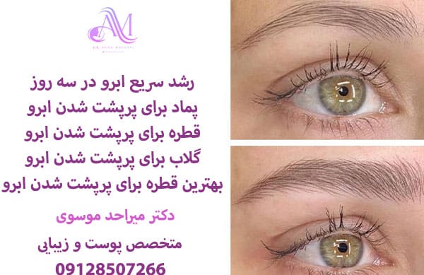 پرپشت کردن ابرو