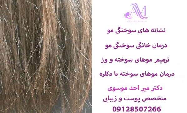 موهای سوخته