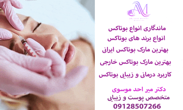 ماندگاری انواع بوتاکس