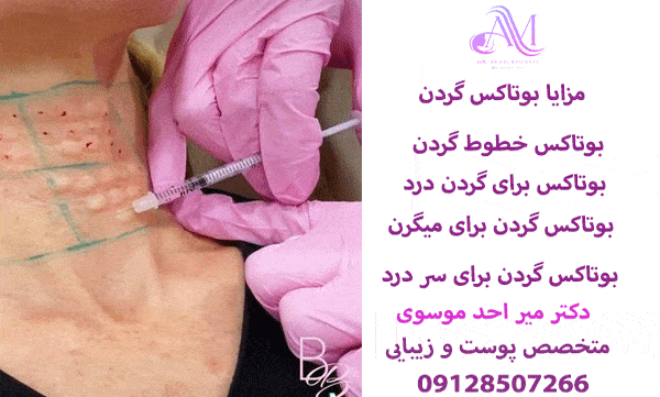 بوتاکس گردن برای سردرد