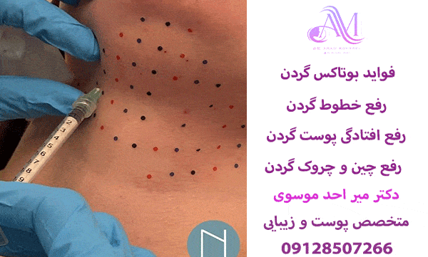 تزریق بوتاکس گردن