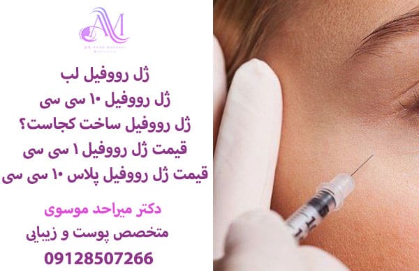 ماندگاری ژل رووفیل