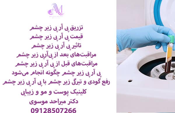 هزینه پی آرپی زیر چشم