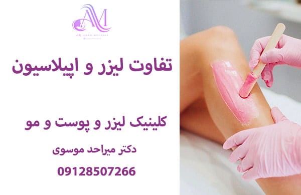 تفاوت لیزر و اپیلاسیون
