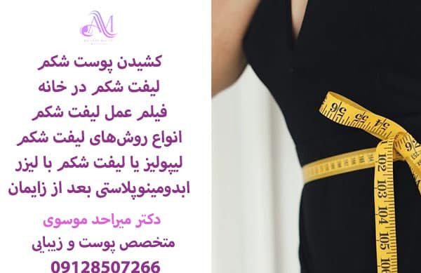 لیفت شکم بدون جراحی