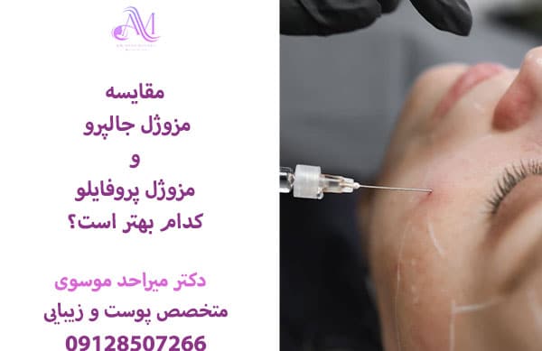 تفاوت جالپرو و پروفایلو از نظر هزینه