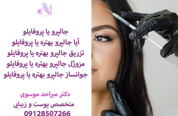 تفاوت جالپرو و پروفایلو