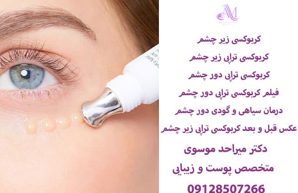 کربوکسی تراپی زیر چشم