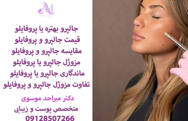 جالپرو بهتره یا پروفایلو