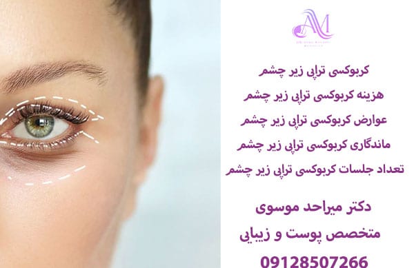 کربوکسی تراپی دور چشم