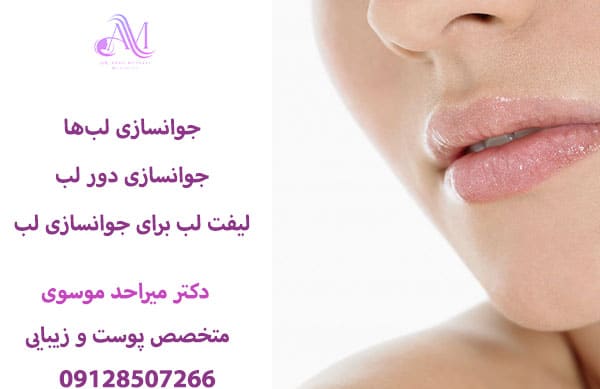 مزوتراپی لب