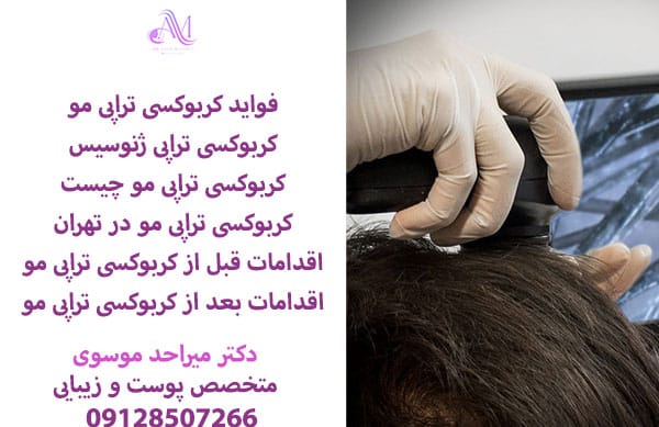 کربوکسی تراپی مو بدون نزریق چیست