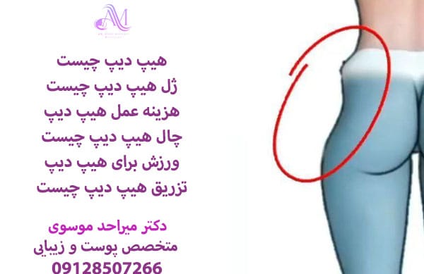 هزینه رفع هیپ دیپ