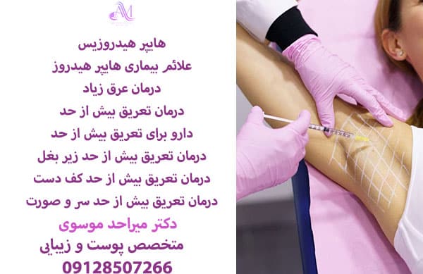 علت تعریق بیش از حد (هایپر هیدروزیس) میتواند ژنتیکی و یا ناشی از استرس و مصرف برخی از داروها باشد.