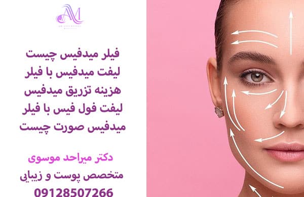 لیفت میدفیس با فیلر