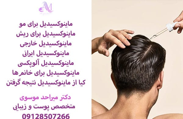 ماینوکسیدیلهای ایرانی و ماینوکسیدیلهای خارجی هر رو در کاهش ریزش مو موثر هستند اما ماینوکسیدیل ایرانی قیمت مناسب تری دارد.