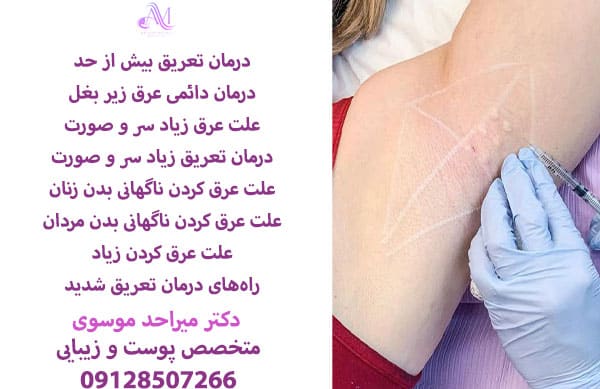 درمان تعریق بیش از حد یا هایپر هیدروزیس با استفاده از بوتاکس و دارو قابل کنترل کردن است.