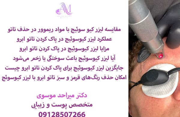 هزینه پاک کردن تاتو ابرو با لیزر کیوسوئیچ به عواملی مانند تعداد جلسات لیزر برای پاک کردن تاتو، وسعت ناحیه تاتو و دستمزد پزشک دارد.