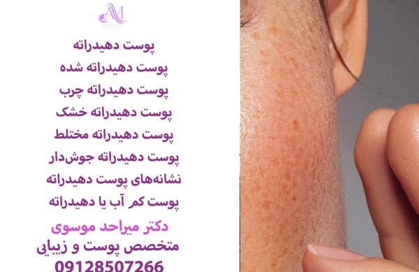 پوست دهیدراته یا کم آب