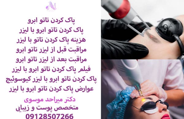 پاک کردن تاتو ابرو با لیزر یکی از موثرترین و ایمن ترین روشها برای ریموو تاتو ابرو است.