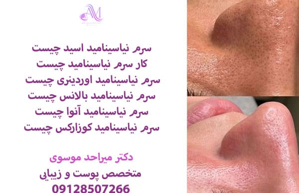 سرم نیاسینامید را میتوان هم در روتین صبح خود هم در روتین پوستی شب استفاده کنید و قبل از استفاده صورت خود را بشویید.