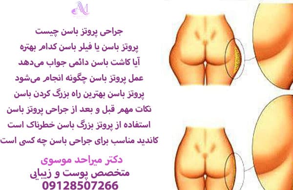 هزینه عمل پروتز باسن به عوامل مختلفی مانند دستمزد جراح، جنس پروتز و نوع بیمارستان بستگی دارد.