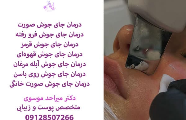 درمان جای جوش صورت