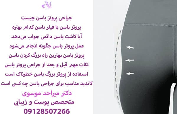 پروتز باسن یا ایمپلنت باسن یکی از دائمیترین روشها برای افزایش حجم باسن و بهترین راه بزرگ کردن باسن است.