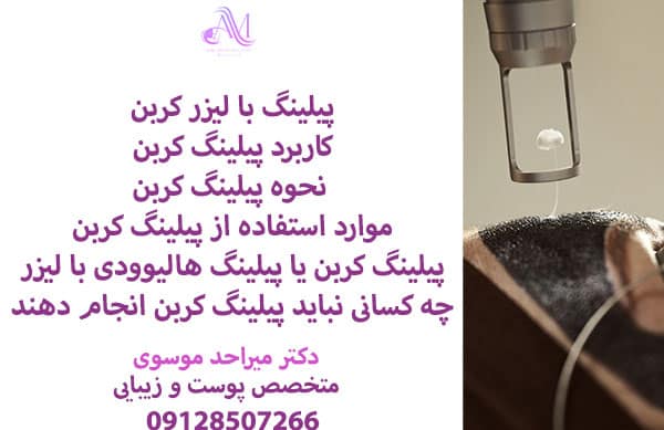 به پیلینگ کربن پیلینگ هالیوودی نیز می گویند، این پیلینگ با استفاده از لیزر کیوسوئیچ انجام میشود.