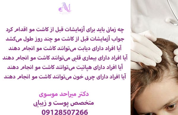 آزمایشات هورمونی قبل از کاشت مو برای افرادی که مشکوک به مشکلات هورمونی هستند ضروری است.