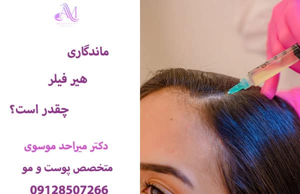 عوامل موثر بر ماندگاری هیر فیلر مو