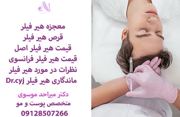 تفاوت ماندگاری انواع هیر فیلر