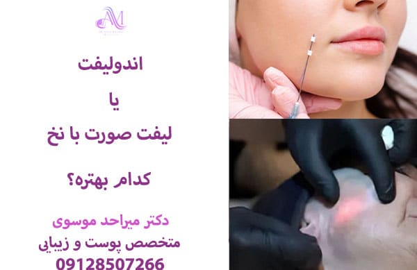 جوانسازی با اندولیفت بهتره یا لیفت صورت با نخ