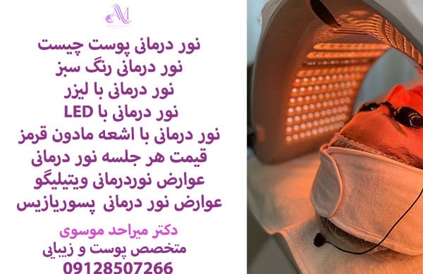 نور درمانی برای ویتیلیگو