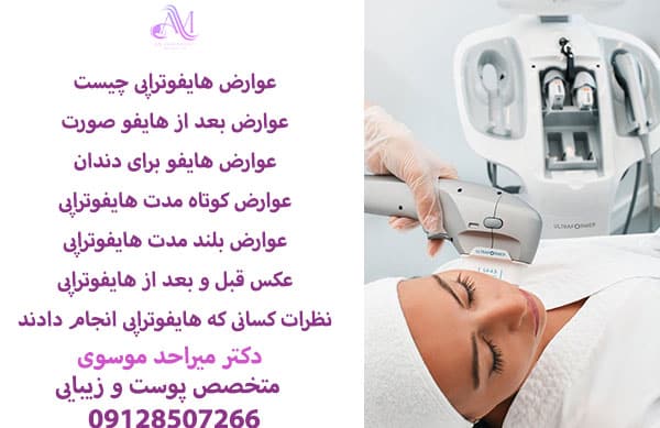 عوارض هایفوتراپی غبغب